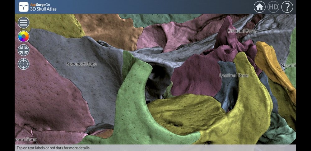 Screenshot_20200303-195909_3D Skull Atlas.jpg