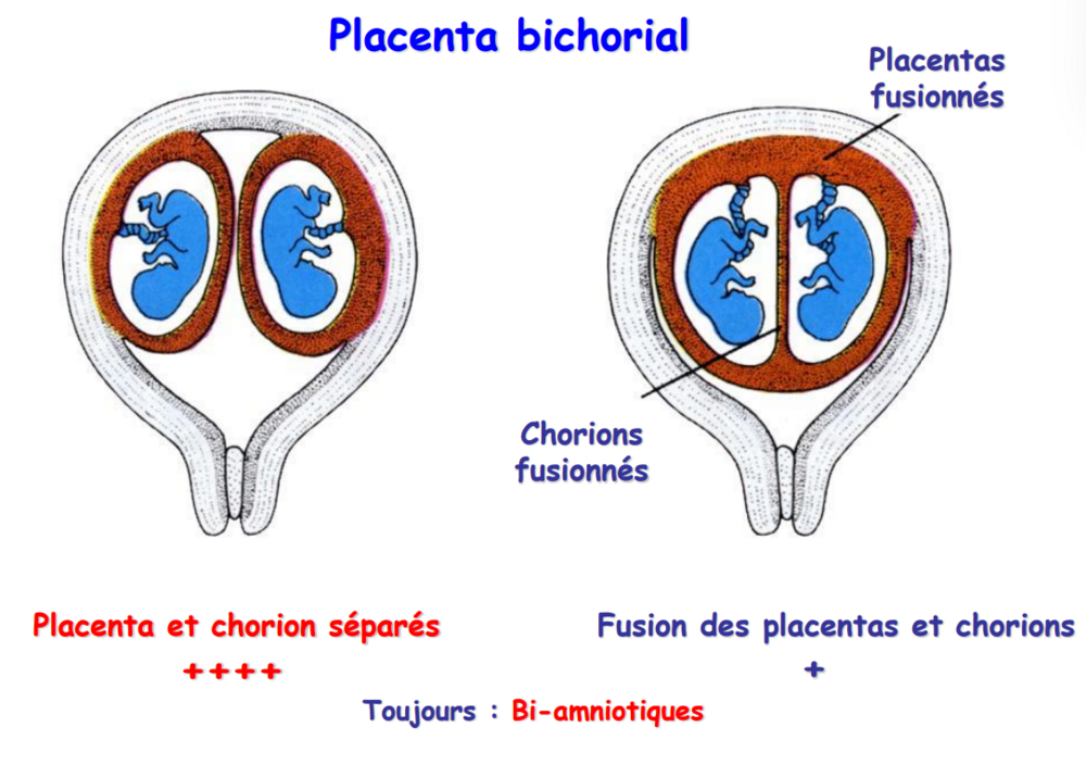 Capture d'écran 2024-03-02 172954.png