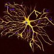 thomASTROCYTE