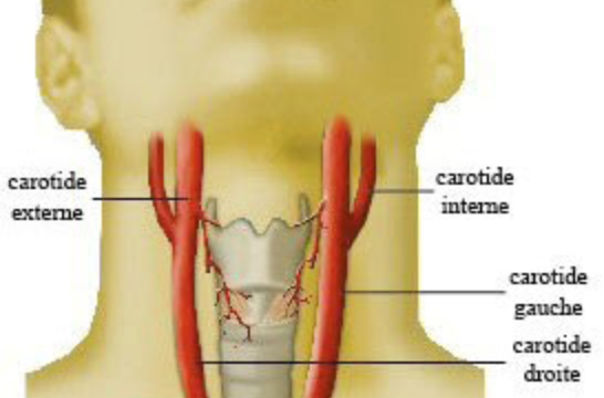bifurcationcarotidienne.png.bcac69a2ef1120a8b729d3b9eb163879.png